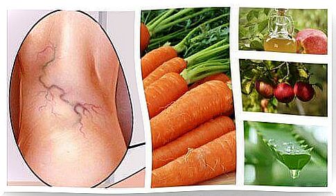 3 ingredient natural treatment for varicose veins