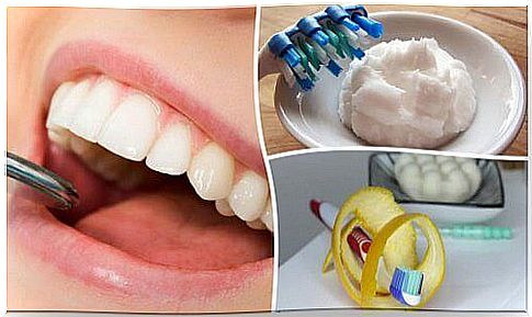 5 home braces for plaque removal from teeth