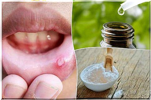 6 natural solutions for oral blisters