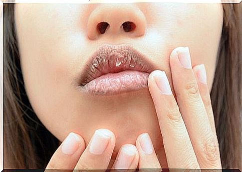 dry lips can be a sign of nutrient deficiencies