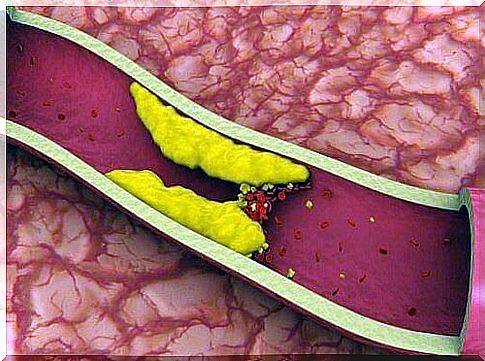 8 extracts for lowering cholesterol