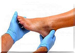 Kidney problems can cause swelling in the ankles.