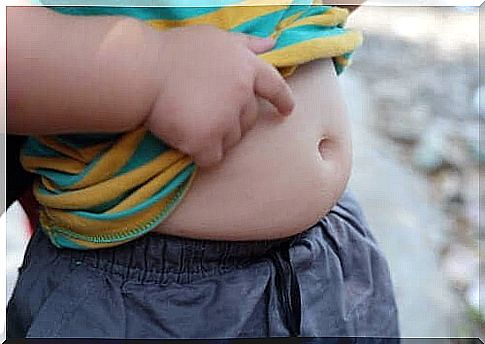 Childhood obesity is a serious problem