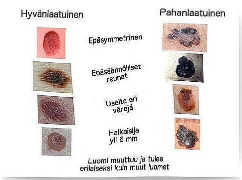 It is important to identify when the eyelid is abnormal.