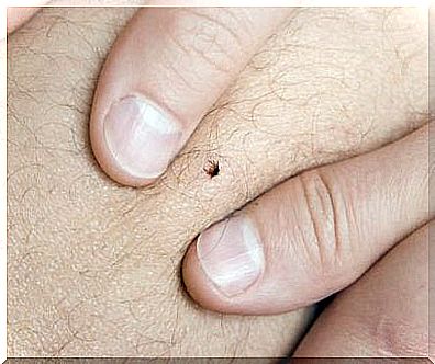 This is how you get rid of ticks