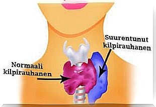 Hyperthyroidism in women: symptoms and recommended food