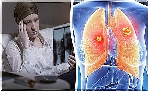 Lung cancer kills more women