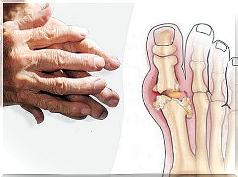 Recommendations for the treatment of joint inflammation