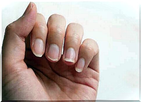 Strengthening brittle nails naturally