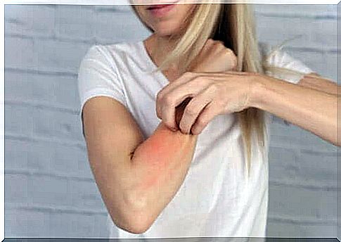 Drug-induced photosensitivity can manifest as a rash