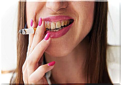 What is the disease of smoker melanosis?